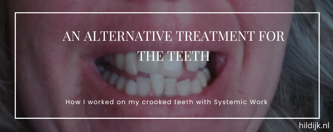 What is an alternative treatment for your teeth Systemic Work can also be used as an alternative healing method for your teeth. Read my experience.