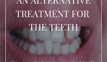 An alternative treatment for the teeth - How I worked on my teeth with Systemic Work