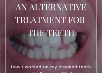 An alternative treatment for the teeth - How I worked on my teeth with Systemic Work