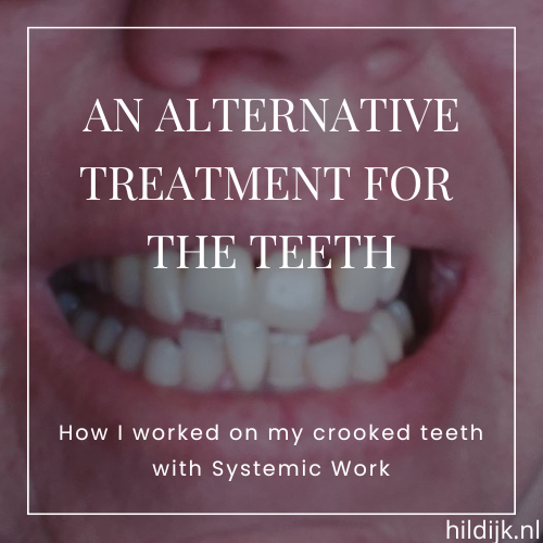 An alternative treatment for the teeth - How I worked on my teeth with Systemic Work